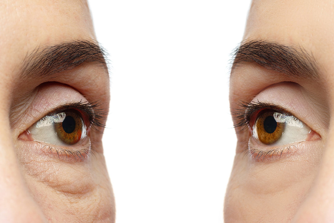 Ojeras · Abades